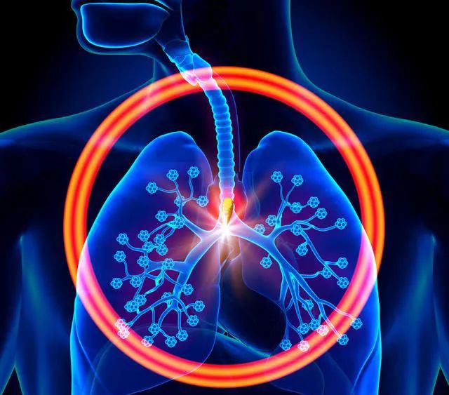 【蓝生科普】肺部为何会长结节，需要治疗吗？